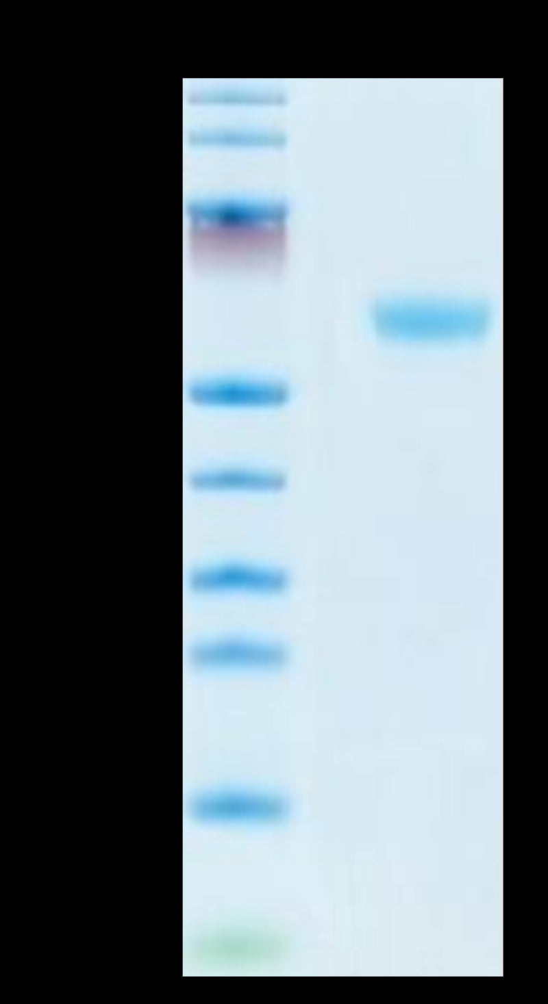 Mouse CD160 on Tris-Bis PAGE under reduced condition. The purity is greater than 95%.Recombinant Mouse CD160 Protein