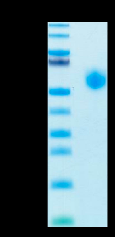 Human Sirpa V8 on Tris-Bis PAGE under reduced condition. The purity is greater than 95%.Recombinant Human SIRP alpha V8 Protein, Active
