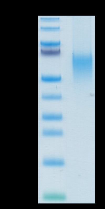 Human B7-1 on Tris-Bis PAGE under reduced condition. The purity is greater than 95%.Recombinant Human B7-1/CD80 Protein, Active