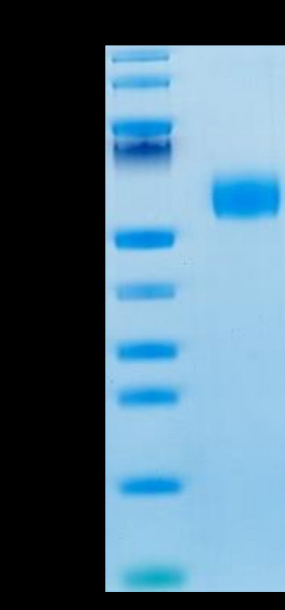 Mouse IL-3 on Tris-Bis PAGE under reduced condition. The purity is greater than 95%.Recombinant Mouse IL-3 Protein