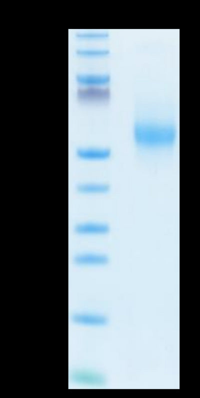 Human IL-3 on Tris-Bis PAGE under reduced condition. The purity is greater than 95%.Recombinant Human IL-3 Protein, Active