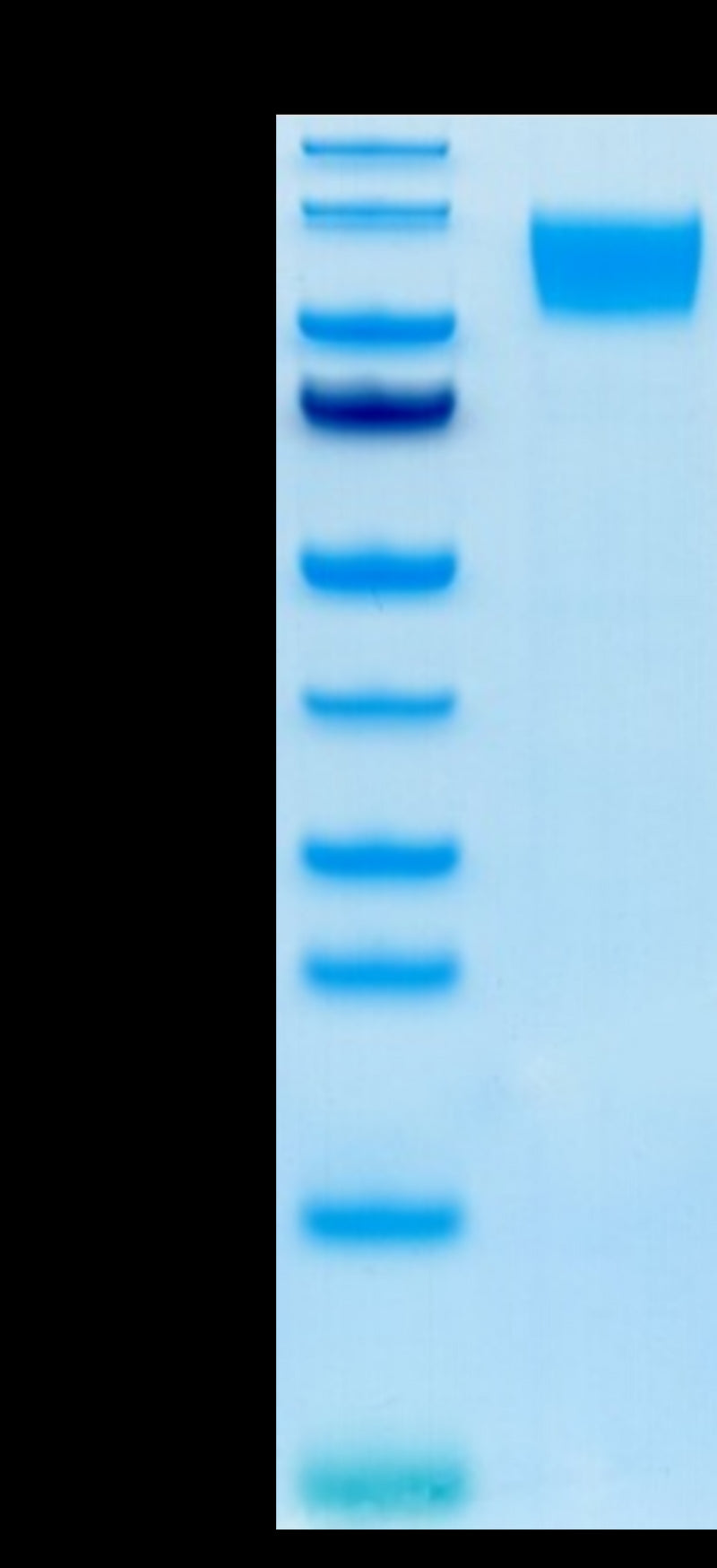 Human GUCY2C on Tris-Bis PAGE under reduced condition. The purity is greater than 95%.Recombinant Human GUCY2C/Guanylyl cyclase C Protein, Active