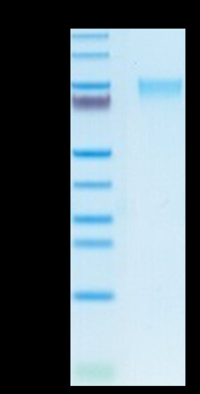 Human GUCY2C on Tris-Bis PAGE under reduced condition. The purity is greater than 95%.Recombinant Human GUCY2C/Guanylyl cyclase C Protein, Active