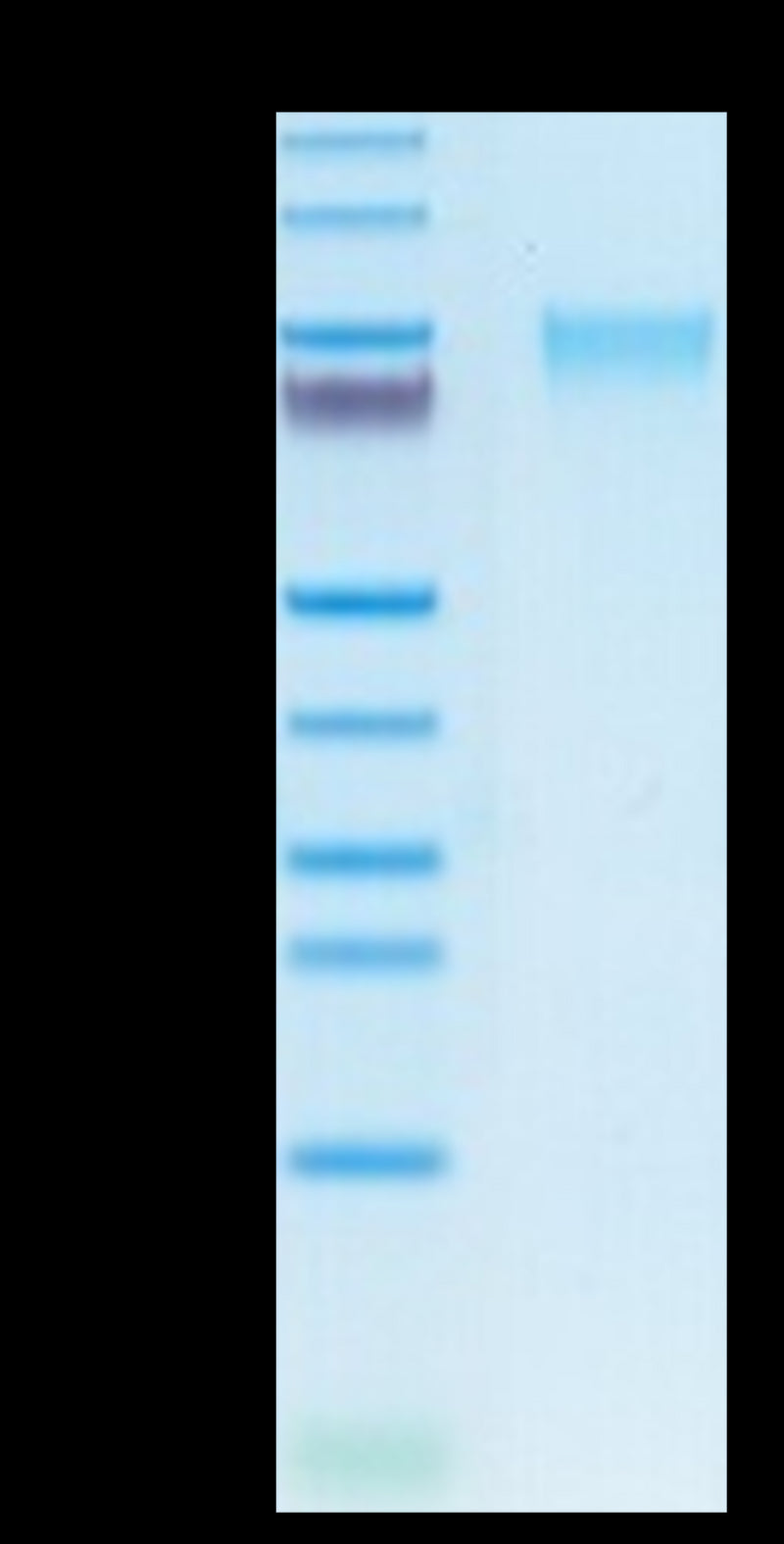 Human GUCY2C on Tris-Bis PAGE under reduced condition. The purity is greater than 95%.Recombinant Human GUCY2C/Guanylyl cyclase C Protein, Active