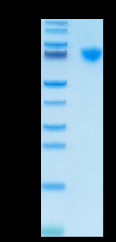 Cynomolgus GUCY2C on Tris-Bis PAGE under reduced condition. The purity is greater than 95%.Recombinant Cynomolgus GUCY2C/Guanylyl cyclase C Protein, Active