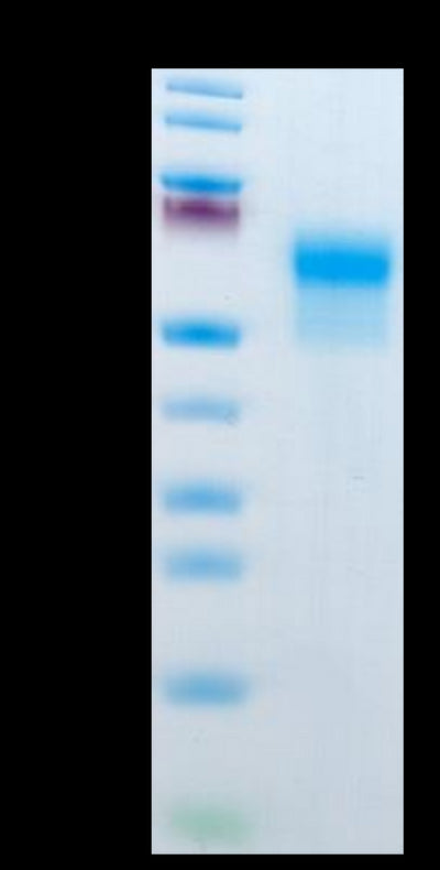 Mouse IL-1R2 on Tris-Bis PAGE under reduced condition. The purity is greater than 95%.Recombinant Mouse IL-1R2/IL-1 RII/CD121b Protein