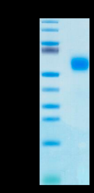 Human IL-1R2 on Tris-Bis PAGE under reduced condition. The purity is greater than 95%.Recombinant Human IL-1R2/IL-1 RII/CD121b Protein, Active