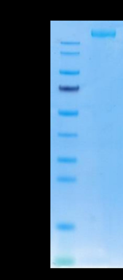 SARS-COV-2 Spike S (Trimer) on Tris-Bis PAGE under reduced condition. The purity is greater than 95%.Recombinant SARS-COV-2 Spike S Trimer Protein, Active