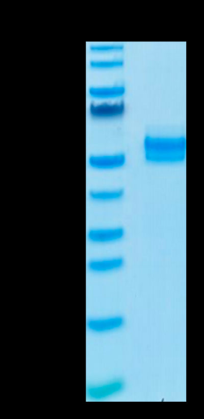 Human TGF-beta RII on Tris-Bis PAGE under reduced condition. The purity is greater than 95%.Recombinant Human TGF-beta RII/TGFBR2 Protein, Active