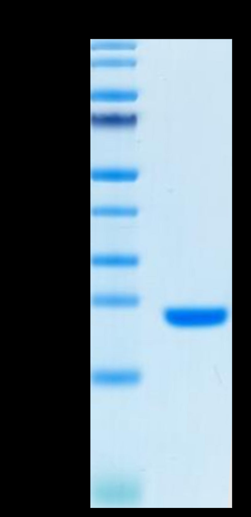 Biotinylated Human FGF10 on Tris-Bis PAGE under reduced condition. The purity is greater than 95%.Biotinylated Human FGF10 Protein (Primary Amine Labeling), Active