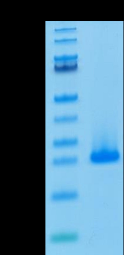 Human FGF10 on Tris-Bis PAGE under reduced condition. The purity is greater than 95%.Recombinant Human FGF10 Protein, Active