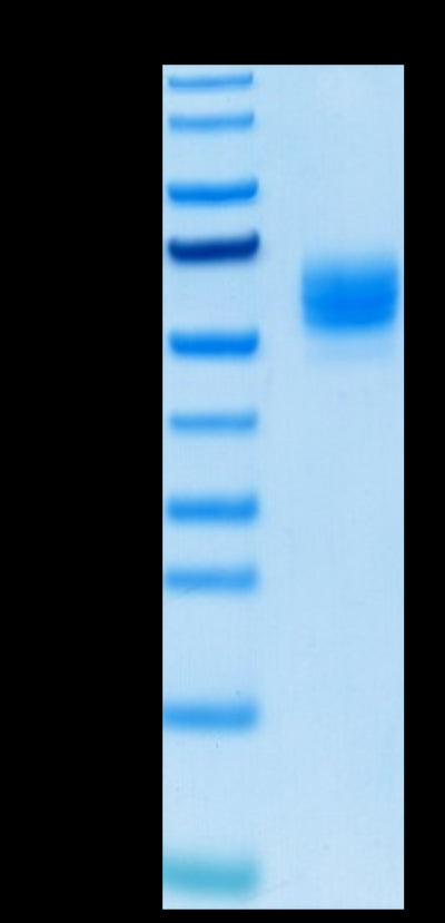 Biotinylated Human GITR Ligand Trimer on Tris-Bis PAGE under reduced condition. The purity is greater than 95%.Biotinylated Human GITR Ligand/TNFSF18 Trimer Protein (Primary Amine Labeling), Active