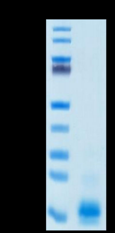 Human MCP-1 on Tris-Bis PAGE under reduced condition. The purity is greater than 95%.Recombinant Human MCP-1/CCL2 Protein