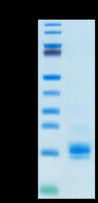 Biotinylated Human MCP-1 on Tris-Bis PAGE under reduced condition. The purity is greater than 95%.Biotinylated Human MCP-1/CCL2 Protein