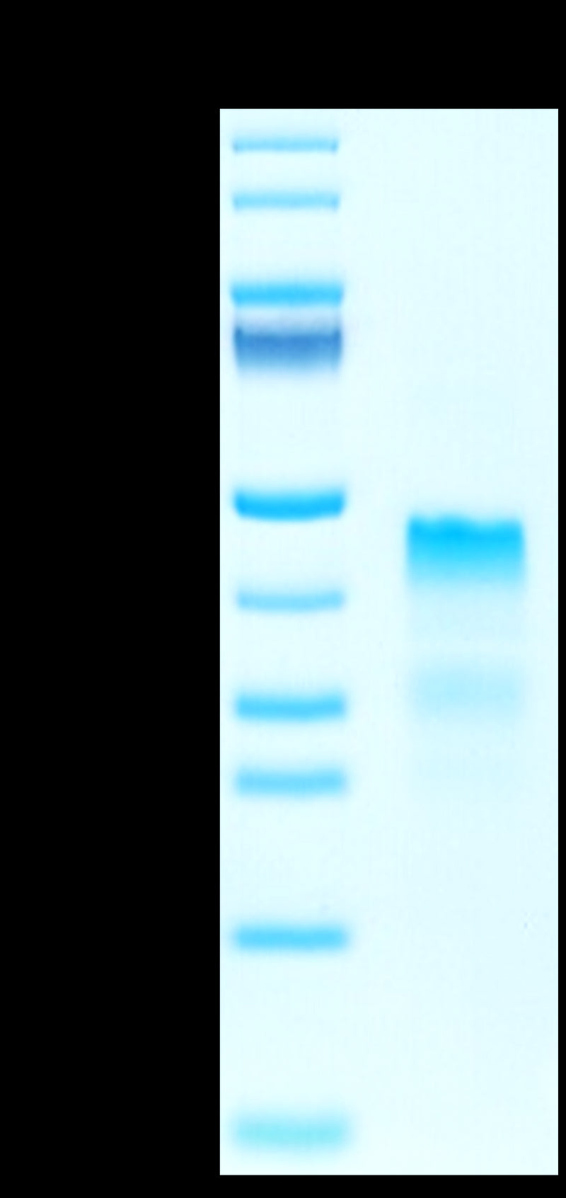 Biotinylated Human RGMa on Tris-Bis PAGE under reduced condition. The purity is greater than 95%.Biotinylated Human RGMa Protein, Active