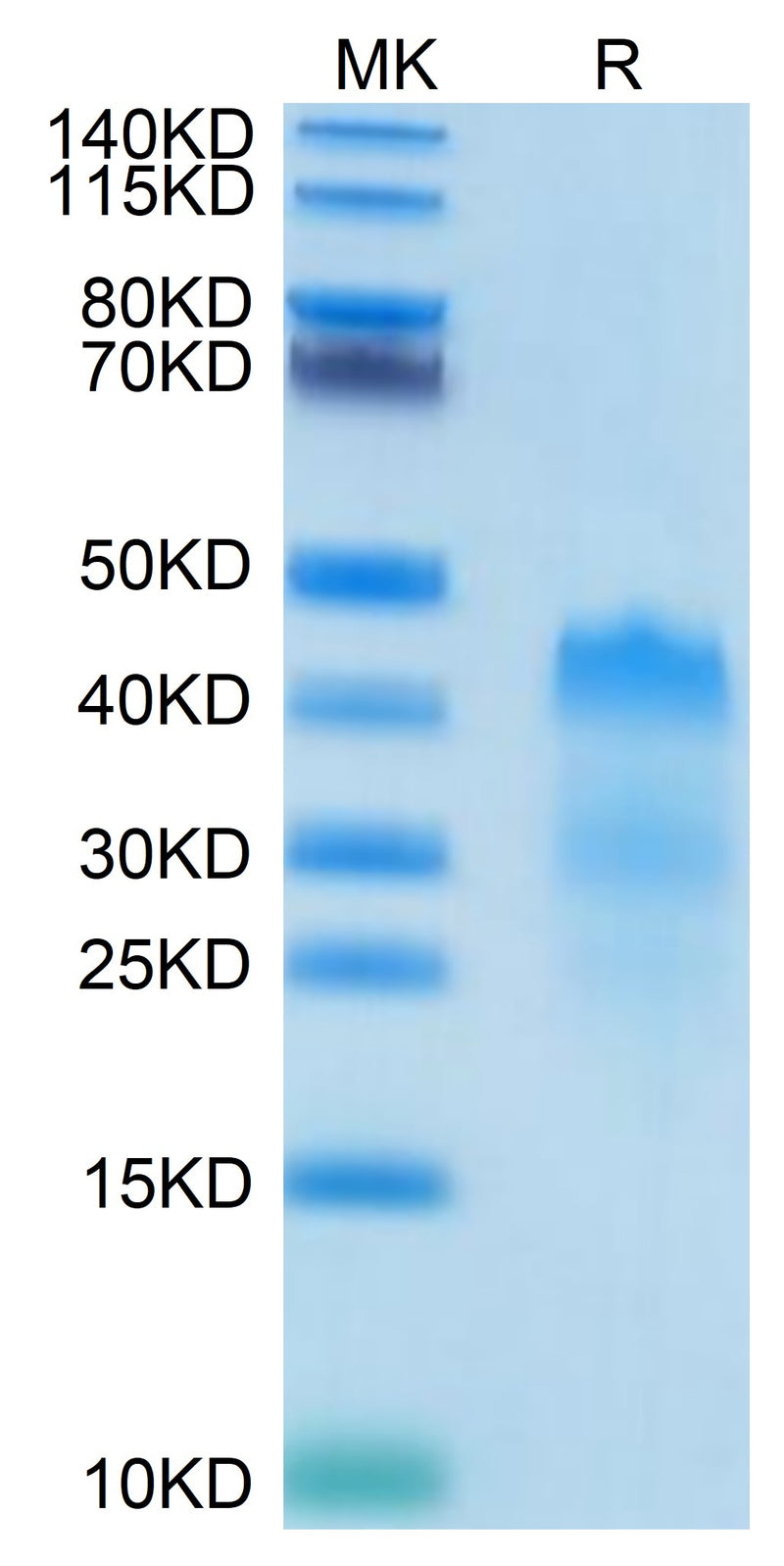 Human RGMa on Tris-Bis PAGE under reduced condition. The purity is greater than 95%.Recombinant Human RGMa Protein, Active