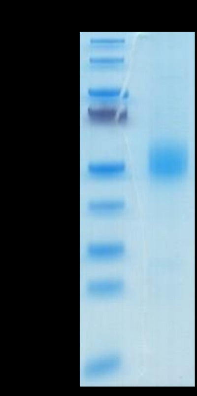 Mouse GFRAL on Tris-Bis PAGE under reduced condition. The purity is greater than 95%.Recombinant Mouse GFRAL/GFR alpha-like Protein, Active