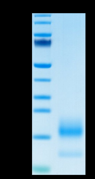 Human BCMA on Tris-Bis PAGE under reduced condition. The purity is greater than 95%.