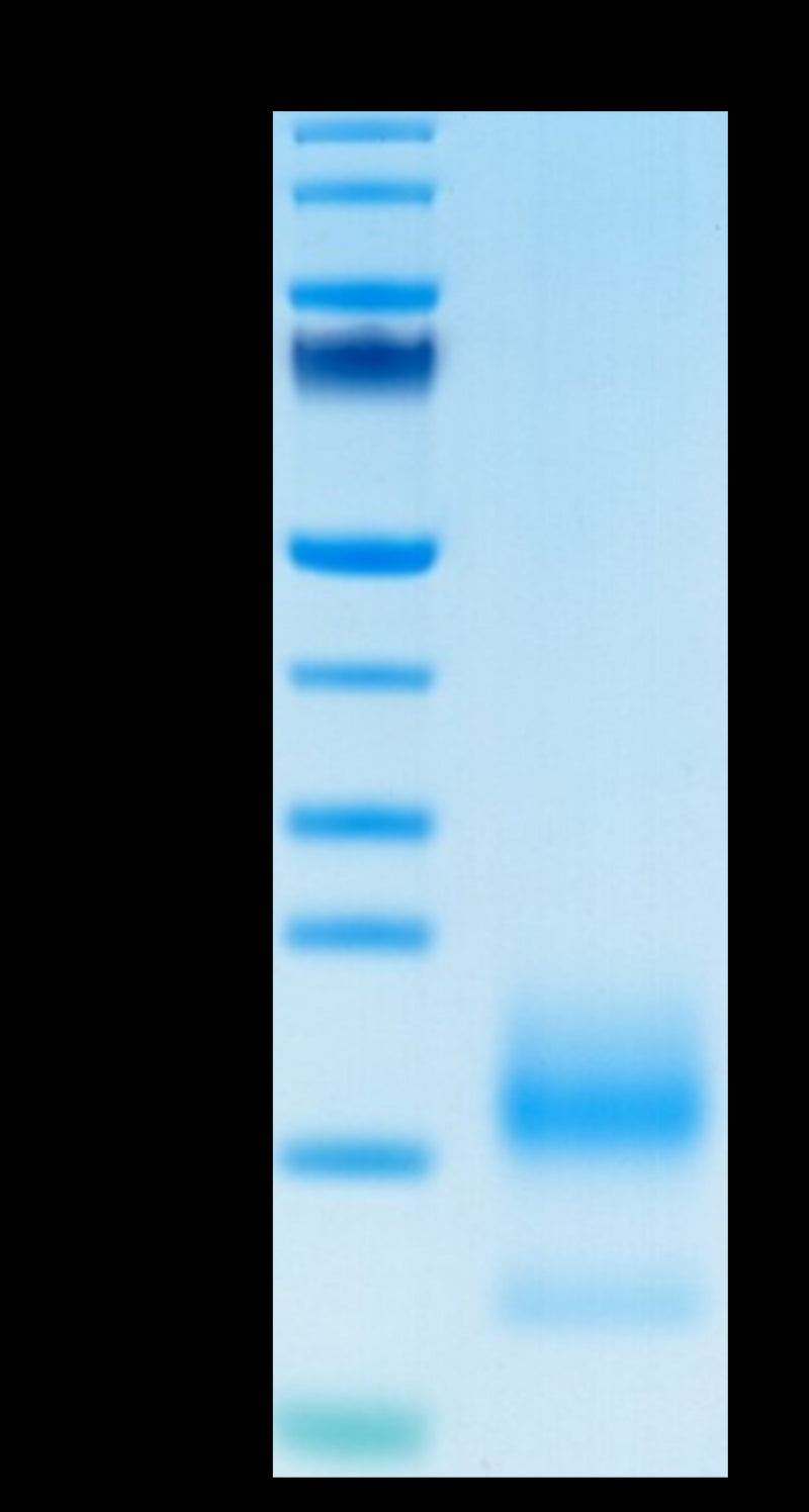Human BCMA on Tris-Bis PAGE under reduced condition. The purity is greater than 95%.Recombinant Human BCMA/TNFRSF17 Protein, Active