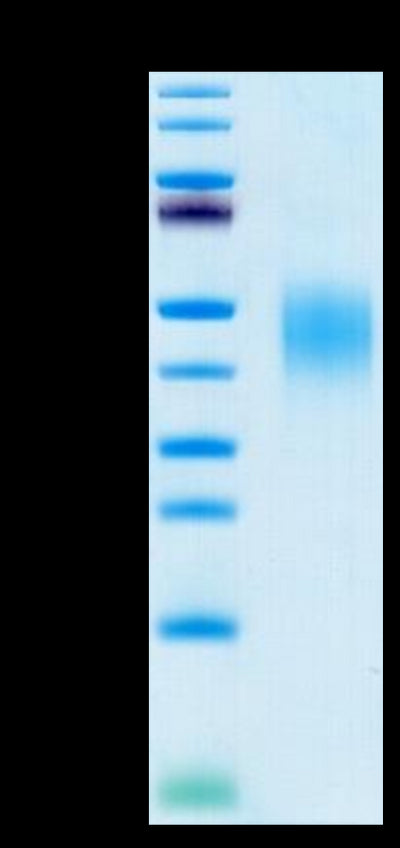 Human PD-L2 on Tris-Bis PAGE under reduced condition. The purity is greater than 95%.Recombinant Human PD-L2/B7-DC Protein, Active