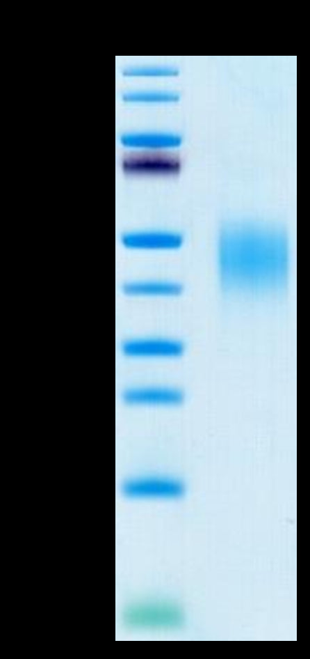 Human PD-L2 on Tris-Bis PAGE under reduced condition. The purity is greater than 95%.Recombinant Human PD-L2/B7-DC Protein, Active