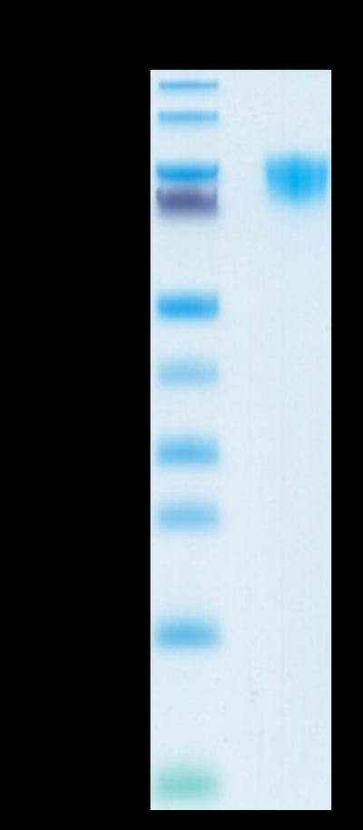 Human PDGF R alpha on Tris-Bis PAGE under reduced condition. The purity is greater than 95%.Recombinant Human PDGF R alpha/PDGFRA Protein, Active