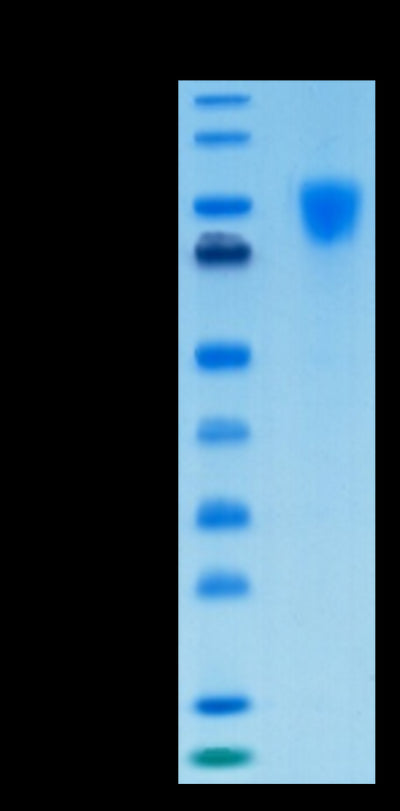 Biotinylated Human PDGF R alpha on Tris-Bis PAGE under reduced condition. The purity is greater than 95%.Biotinylated Human PDGF R alpha/PDGFRA Protein, Active
