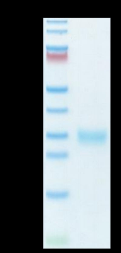 Human ULBP-1 on Tris-Bis PAGE under reduced condition. The purity is greater than 95%.Recombinant Human ULBP-1 Protein, Active