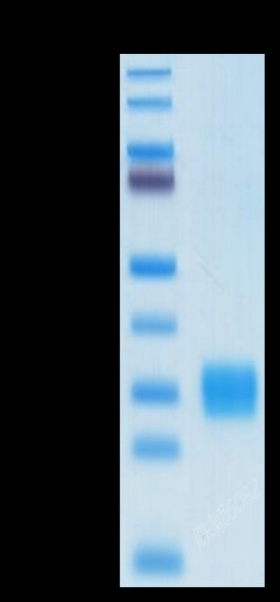 Biotinylated Human ULBP-1 on Tris-Bis PAGE under reduced condition. The purity is greater than 95%.Biotinylated Human ULBP-1 Protein, Active