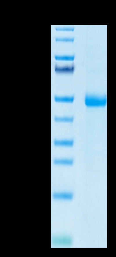 Human KIR3DL3 on Tris-Bis PAGE under reduced condition. The purity is greater than 95%.Recombinant Human KIR3DL3 Protein, Active