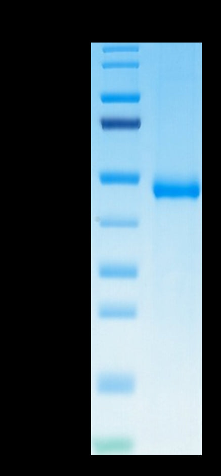Biotinylated Human KIR3DL3 on Tris-Bis PAGE under reduced condition. The purity is greater than 95%.Biotinylated Human KIR3DL3 Protein, Active