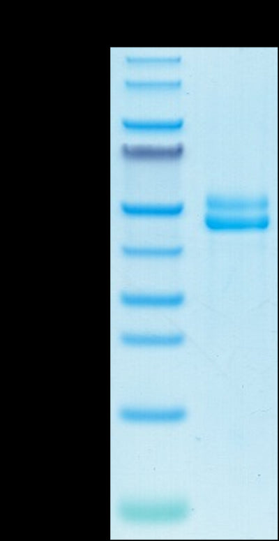 Biotinylated CD3E&CD3G on Tris-Bis PAGE under reduced condition. The purity is greater than 95%.Biotinylated Human CD3E&CD3G/CD3 epsilon&CD3 gamma Protein, Active