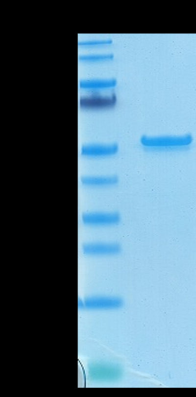 Biotinylated SARS-COV-2 Nucleocapsid on Tris-Bis PAGE under reduced condition. The purity is greater than 95%.Recombinant Bioytinylated SARS-COV-2 Nucleocapsid Protein