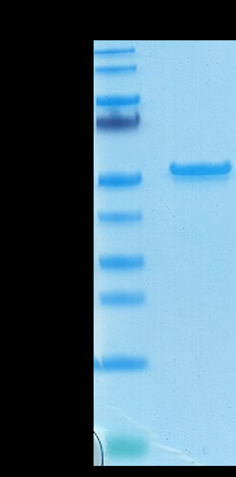 Biotinylated SARS-COV-2 Nucleocapsid on Tris-Bis PAGE under reduced condition. The purity is greater than 95%.Recombinant Bioytinylated SARS-COV-2 Nucleocapsid Protein