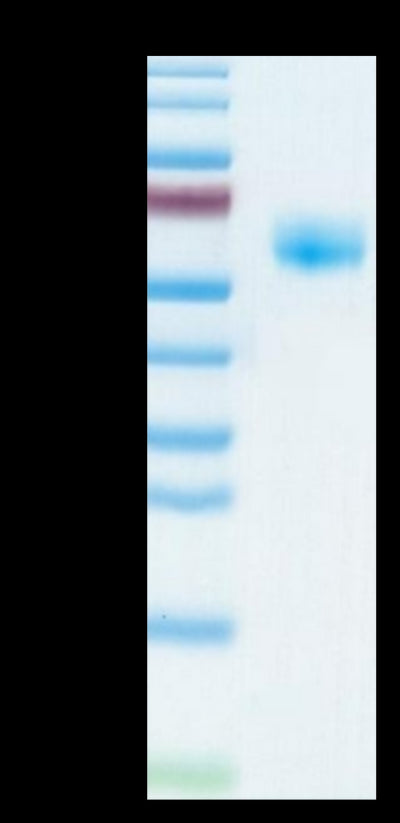 Human NKG2A&CD94 on Tris-Bis PAGE under reduced condition. The purity is greater than 95%.Recombinant Human NKG2A&CD94 Protein, Active