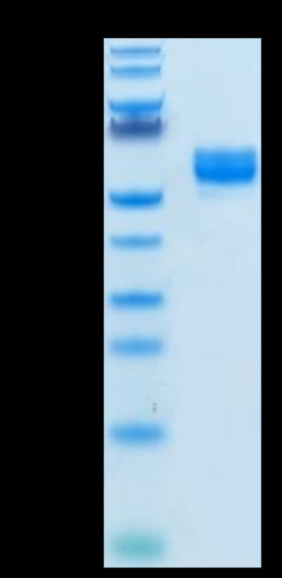 Human NKG2A&CD94 on Tris-Bis PAGE under reduced condition. The purity is greater than 95%.Recombinant Human NKG2A&CD94 Protein, Active