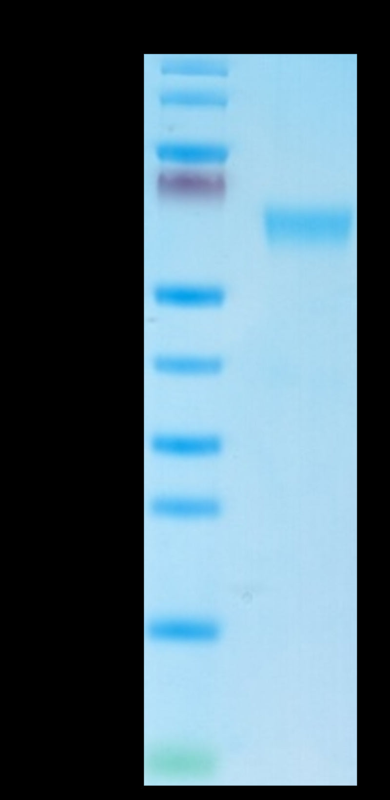 Mouse NKG2A&CD94 on Tris-Bis PAGE under reduced condition. The purity is greater than 95%.Recombinant Mouse NKG2A&CD94 Protein