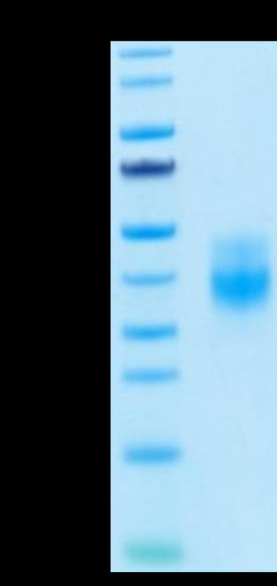 Biotinylated Human NKG2A&CD94 on Tris-Bis PAGE under reduced condition. The purity is greater than 95%.Biotinylated Human NKG2A&CD94 Protein, Active