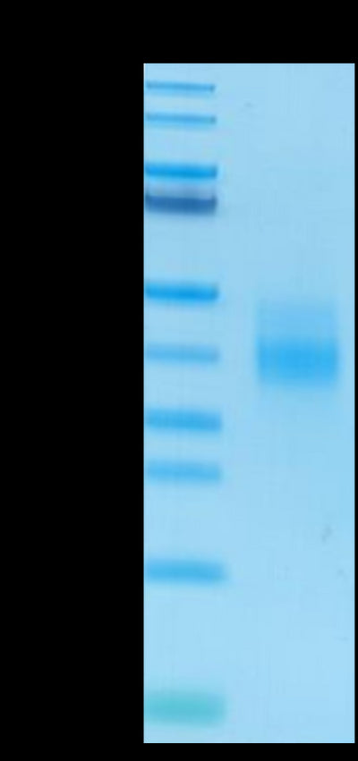 Human NKG2A&CD94 on Tris-Bis PAGE under reduced condition. The purity is greater than 95%.Recombinant Human NKG2A&CD94 Protein, Active