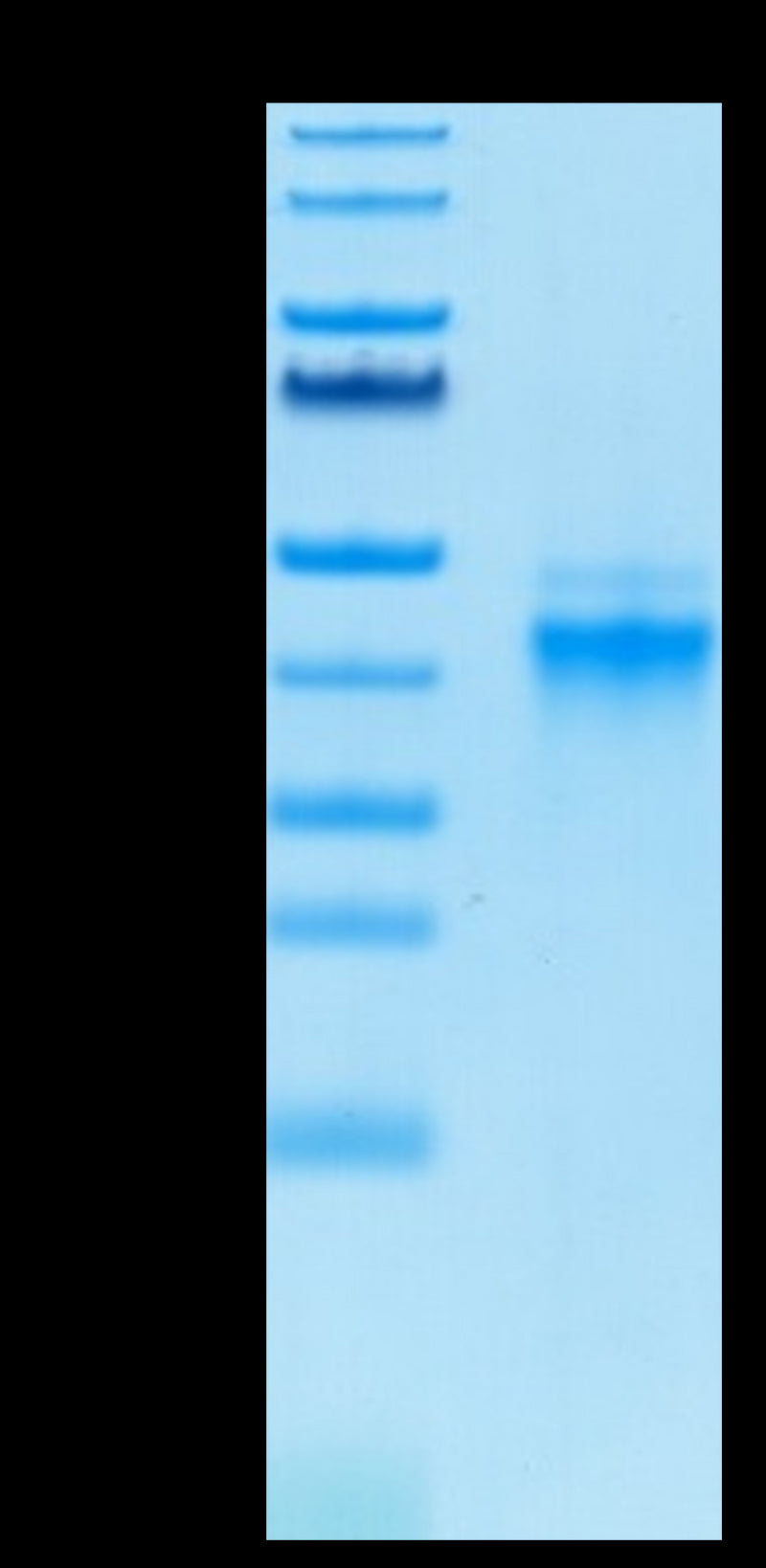 Biotinylated Human IL-12 on Tris-Bis PAGE under reduced condition. The purity is greater than 95%.Biotinylated Human IL-12 Protein, Active