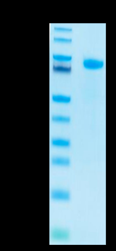 Human Notch 1 on Tris-Bis PAGE under reduced conditions. The purity is greater than 95%.Recombinant Human Notch 1 Protein, Active