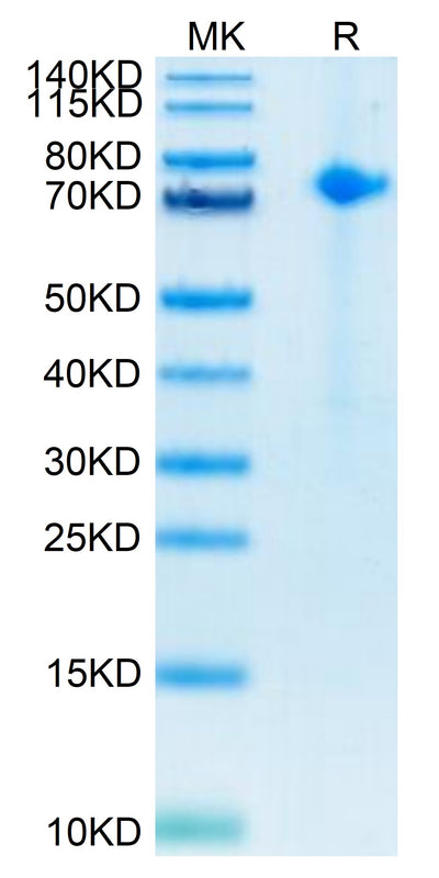 Biotinylated Human Notch 1 on Tris-Bis PAGE under reduced conditions. The purity is greater than 95%.Biotinylated Human Notch 1 Protein, Active