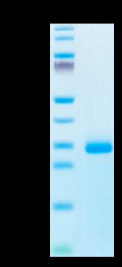 Human Noggin on Tris-Bis PAGE under reduced condition. The purity is greater than 95%.Recombinant Human Noggin Protein