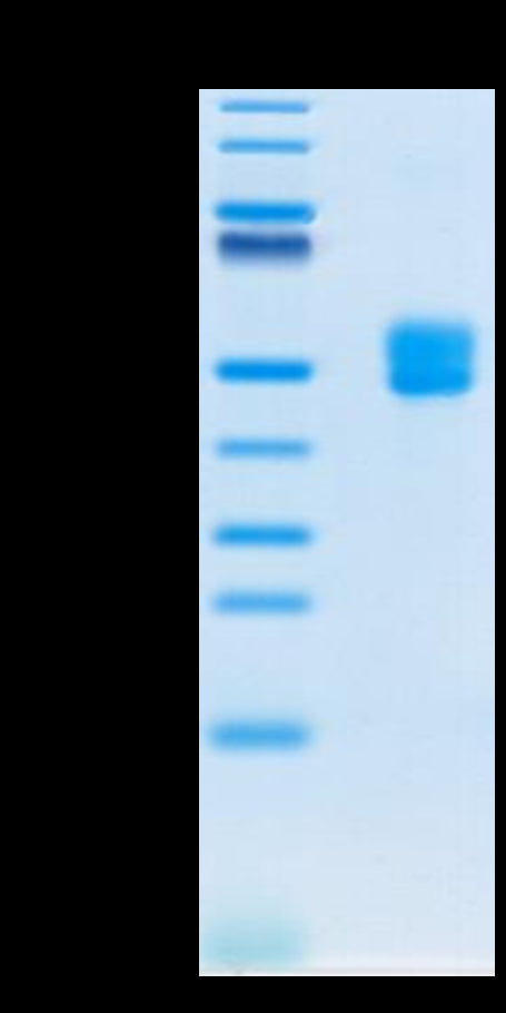 Biotinylated Human CD3E&CD3D on Tris-Bis PAGE under reduced condition. The purity is greater than 95%.Biotinylated Human CD3E&CD3D/CD3 epsilon&CD3 delta Protein, Active