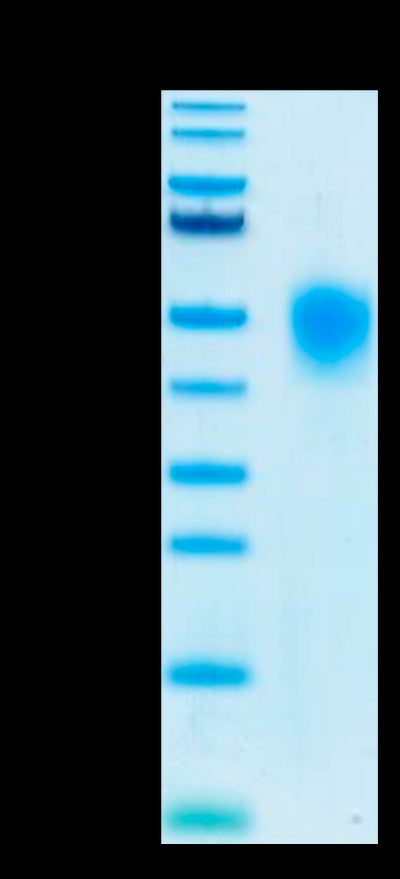 Human KIR2DL1 on Tris-Bis PAGE under reduced conditions. The purity is greater than 95%.Recombinant Human KIR2DL1 Protein