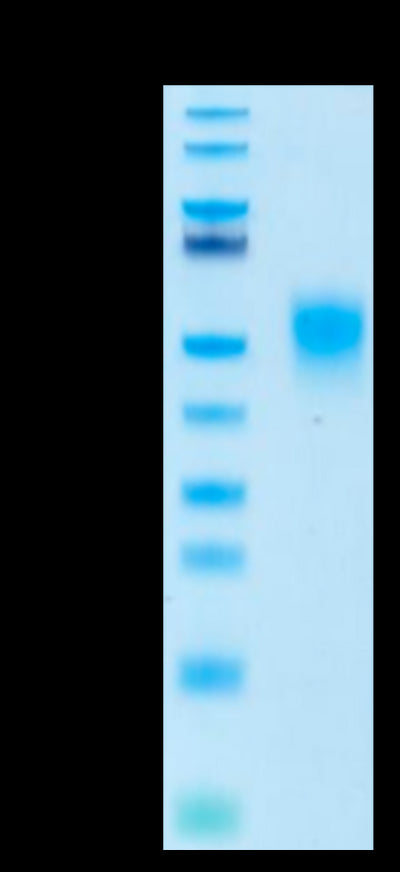 Biotinylated Human KIR2DL1 on Tris-Bis PAGE under reduced conditions. The purity is greater than 95%.Biotinylated Human KIR2DL1 Protein