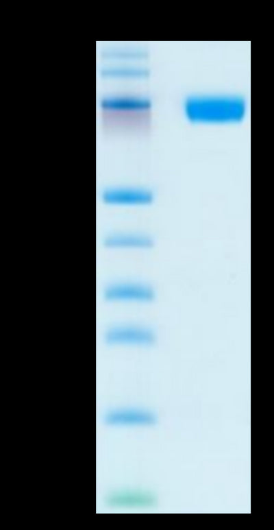 Human CD200 R1 on Tris-Bis PAGE under reduced condition. The purity is greater than 95%.Recombinant Human CD200 R1/CRTR2 Protein, Active