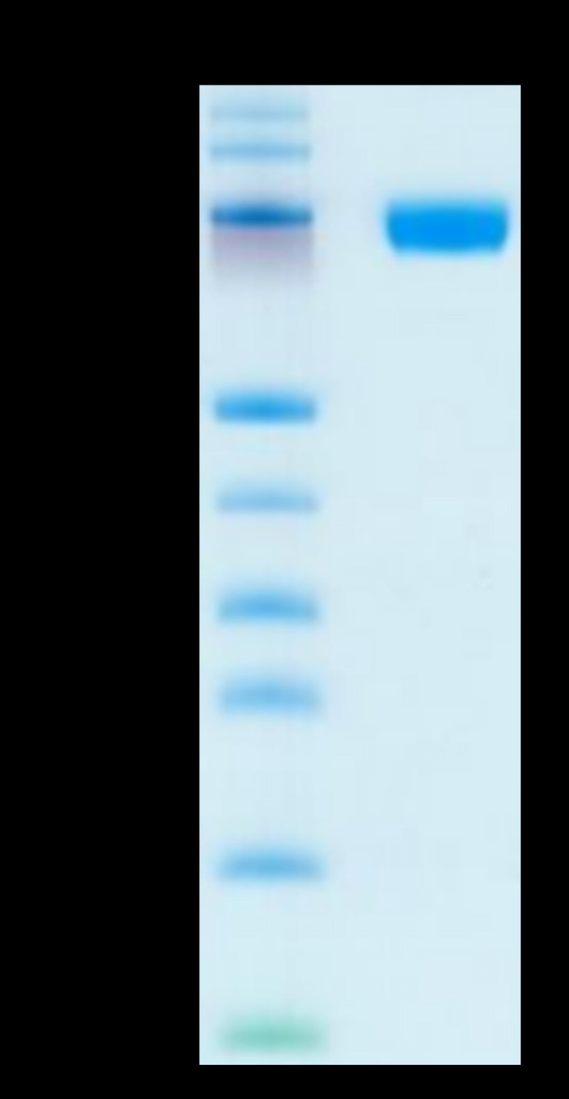 Human CD200 R1 on Tris-Bis PAGE under reduced condition. The purity is greater than 95%.Recombinant Human CD200 R1/CRTR2 Protein, Active