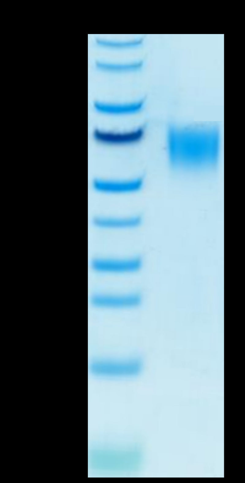 Biotinylated Human CD200 R1 on Tris-Bis PAGE under reduced condition. The purity is greater than 95%.Biotinylated Human CD200 R1/CRTR2 Protein, Active