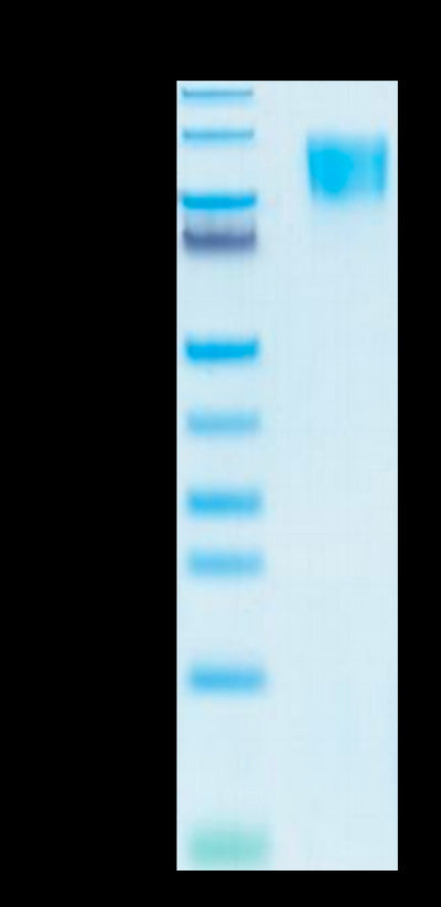 Human PDGF R beta on Tris-Bis PAGE under reduced conditions. The purity is greater than 95%.Recombinant Human PDGF R beta/CD140b Protein, Active